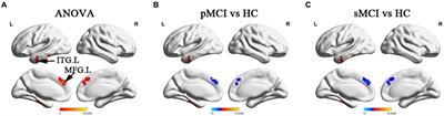 Alteration in temporal-cerebellar effective connectivity can effectively distinguish stable and progressive mild cognitive impairment